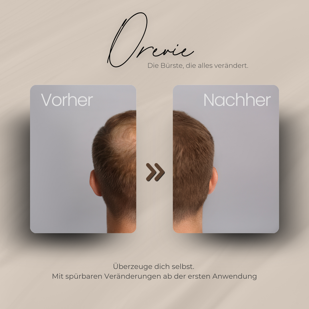 Orevie - Deine revolutionäre Bürste